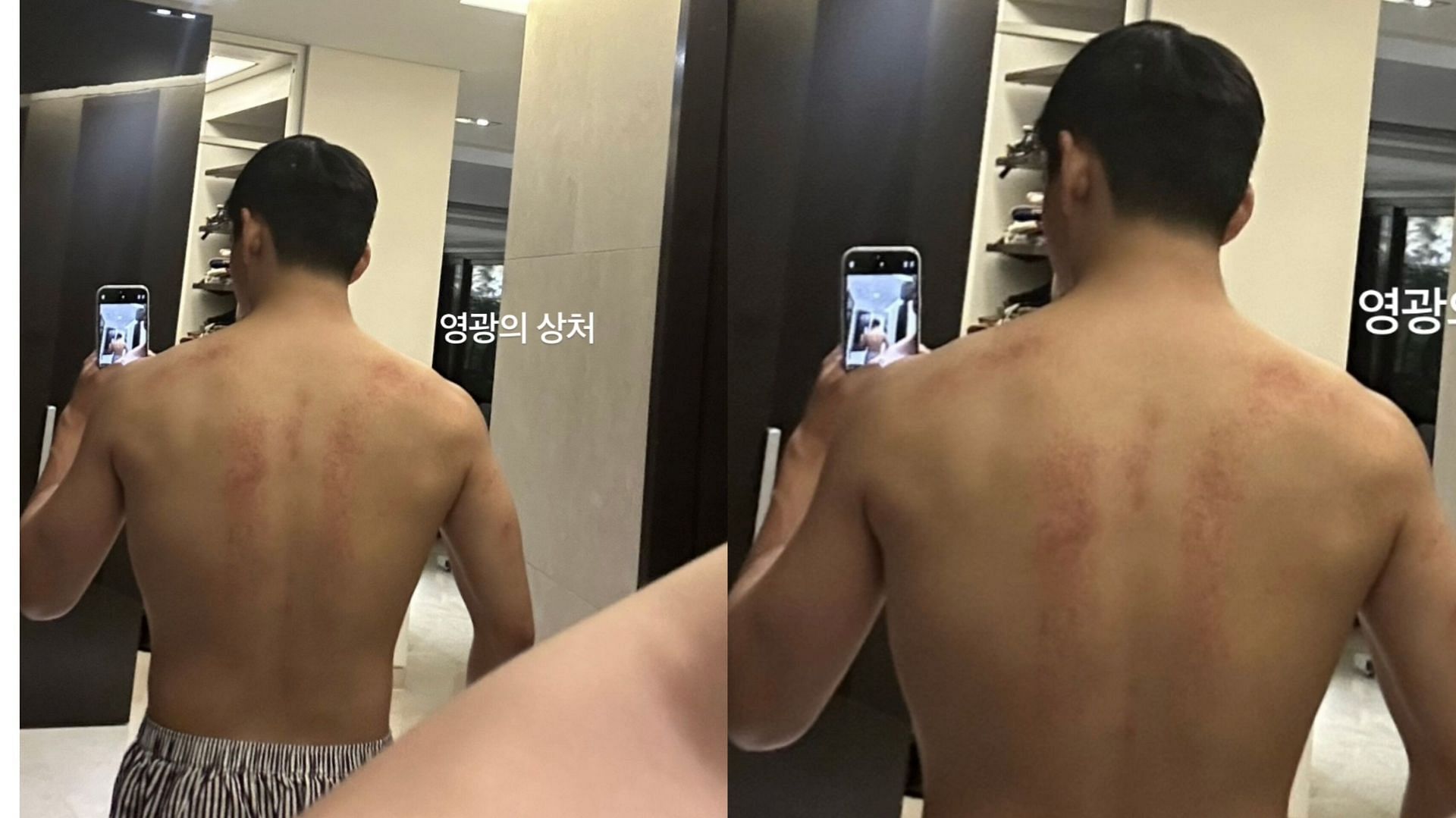 V's "Wounds of Glory" (Image via Weverse)